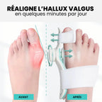 Hallux Valgus Corrector Pro
