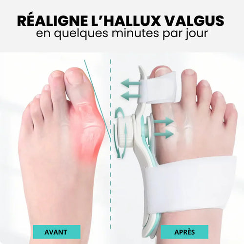 Hallux Valgus Corrector Pro